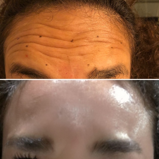 PELZ DERMA CLINIC Dra. Karen Fabiola Velasquez Hernandez, Dermatólogo — foto 4
