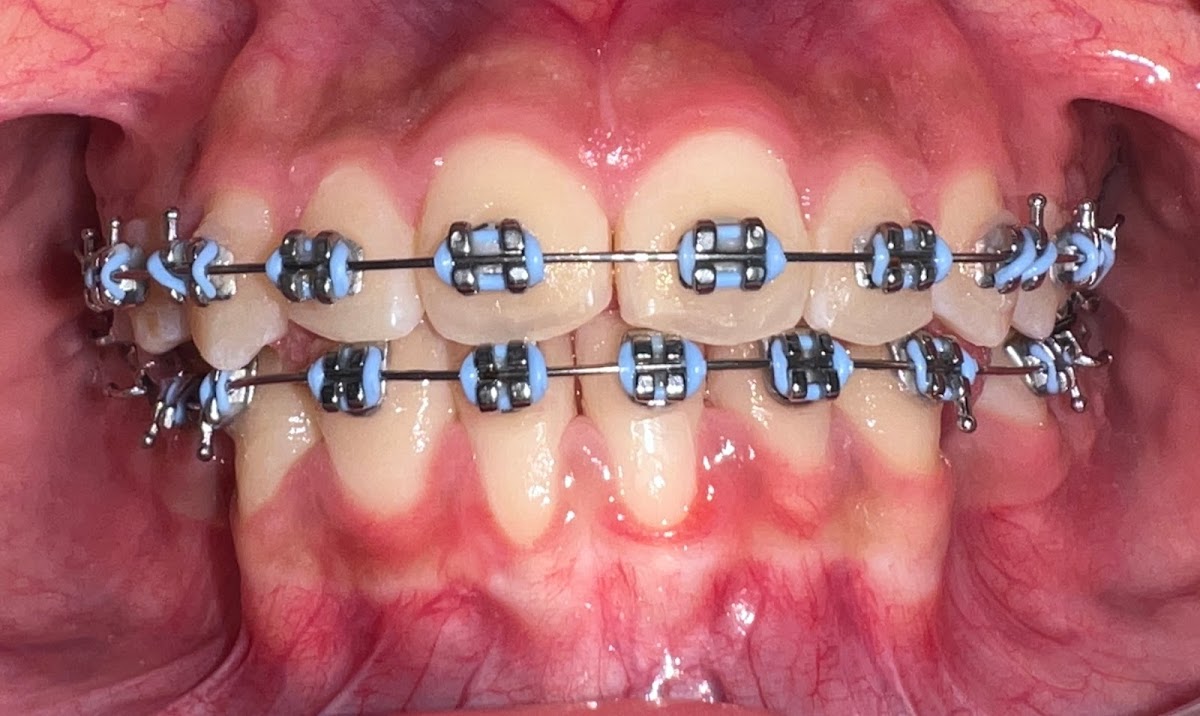 ABC DENTAL ORTODONCIA La Joya — foto 3
