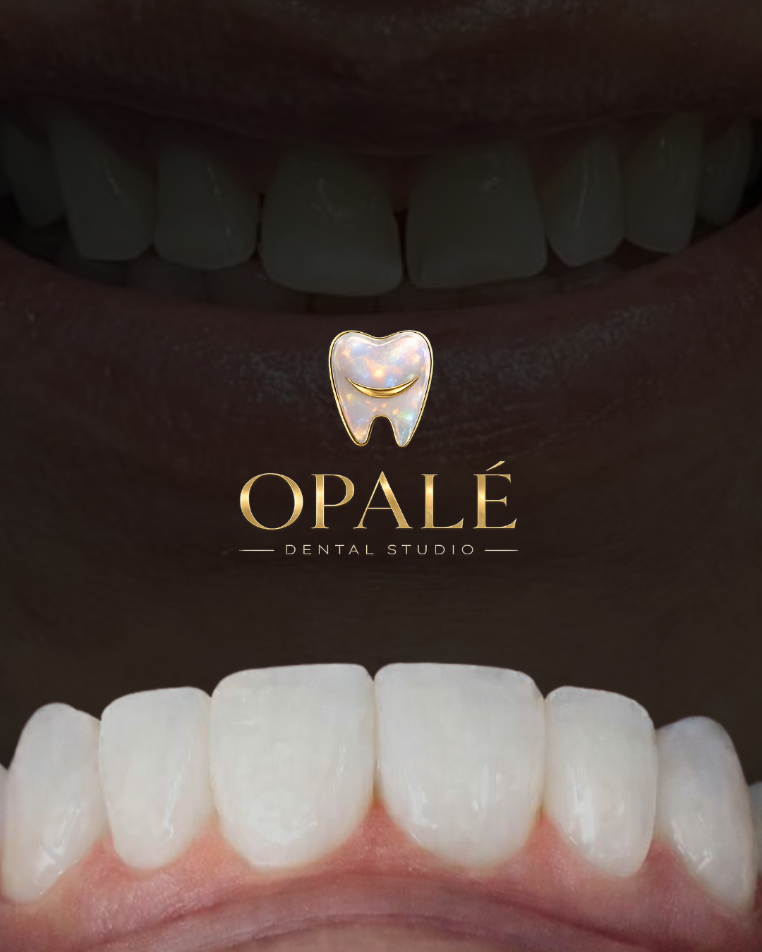 Opalé Dental Studio, Otras zonas