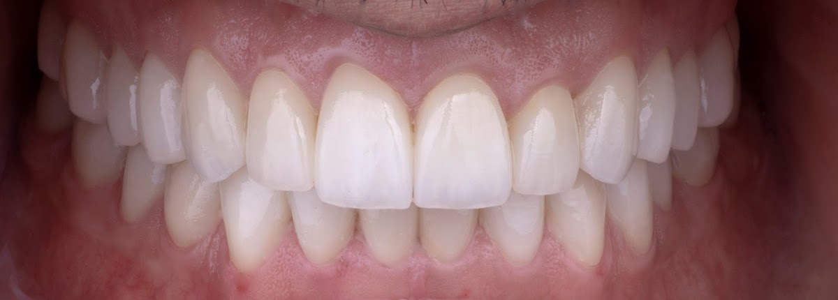 Dental Health Galaviz, Otras zonas