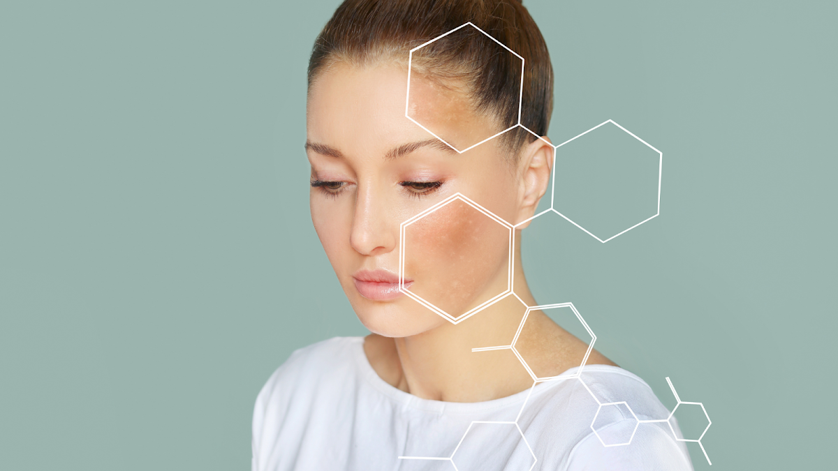 DERMACNÉ - Dra. Gloria Rosales | Clínica Dermatológica Monterrey — foto 2