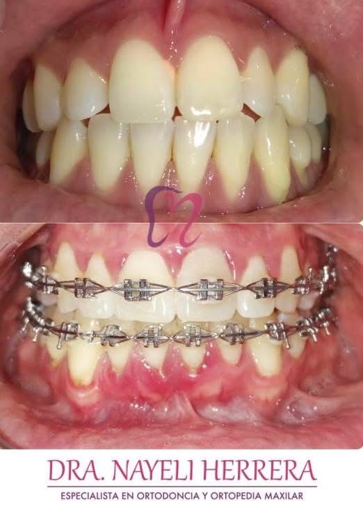 Dra. Nayeli Herrera. Dentista en Morelia, Altozano