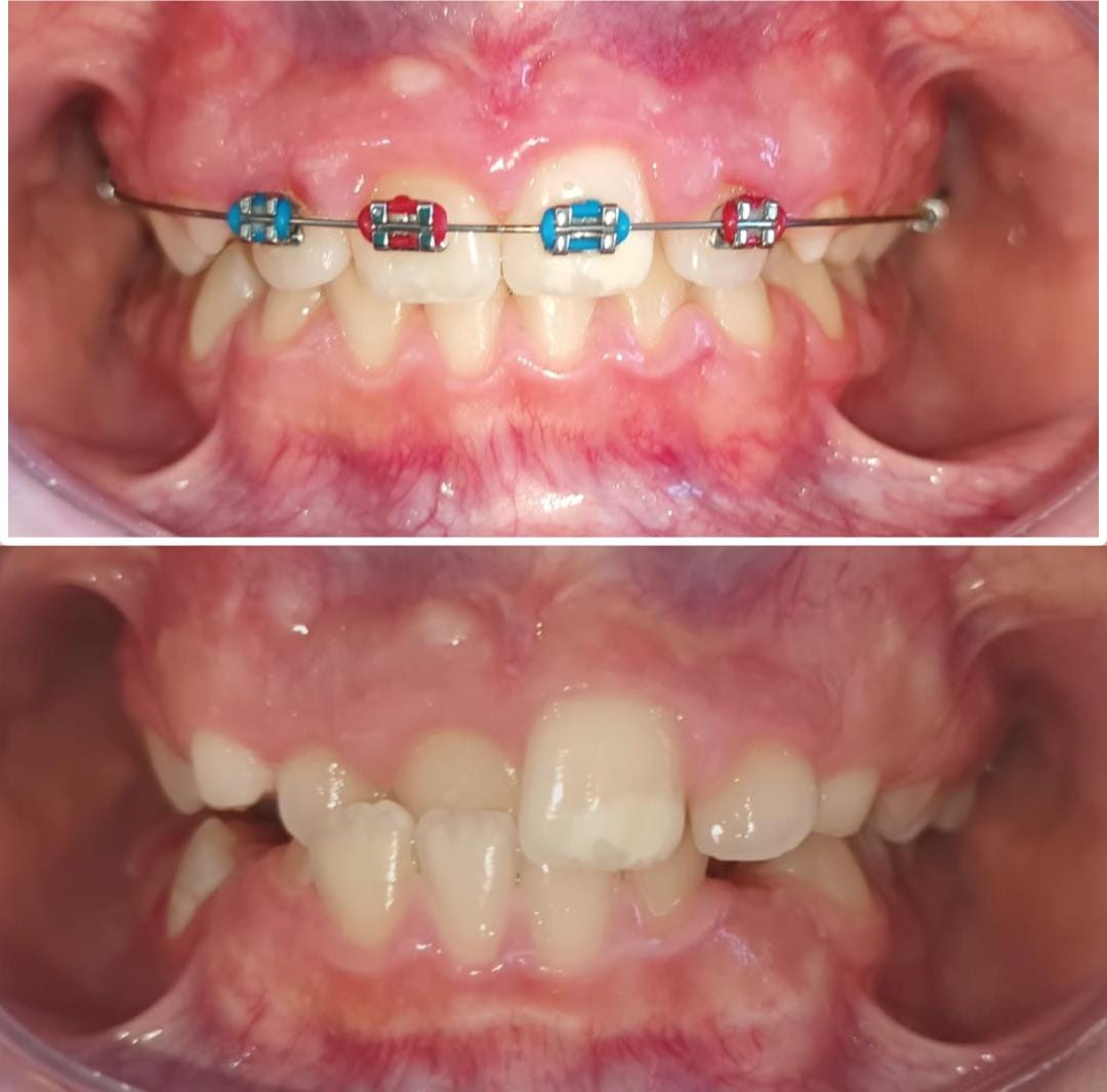 Dra. Nayeli Herrera. Dentista en Morelia — foto 2