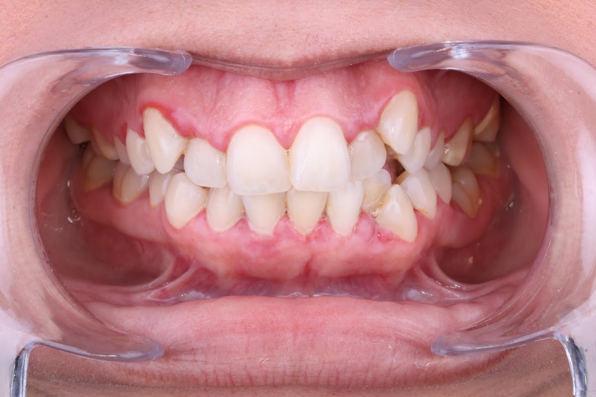 Zental Odontología - Cumbres - Clínica Dental Monterrey, Cumbres