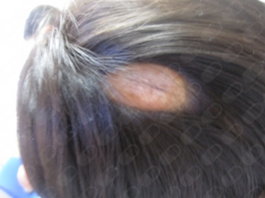 Dr. André Morales Martínez, Dermatólogo — foto 2