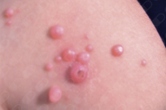 Dr. André Morales Martínez, Dermatólogo — foto 3
