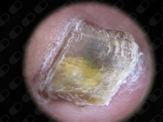 Dr. André Morales Martínez, Dermatólogo — foto 4