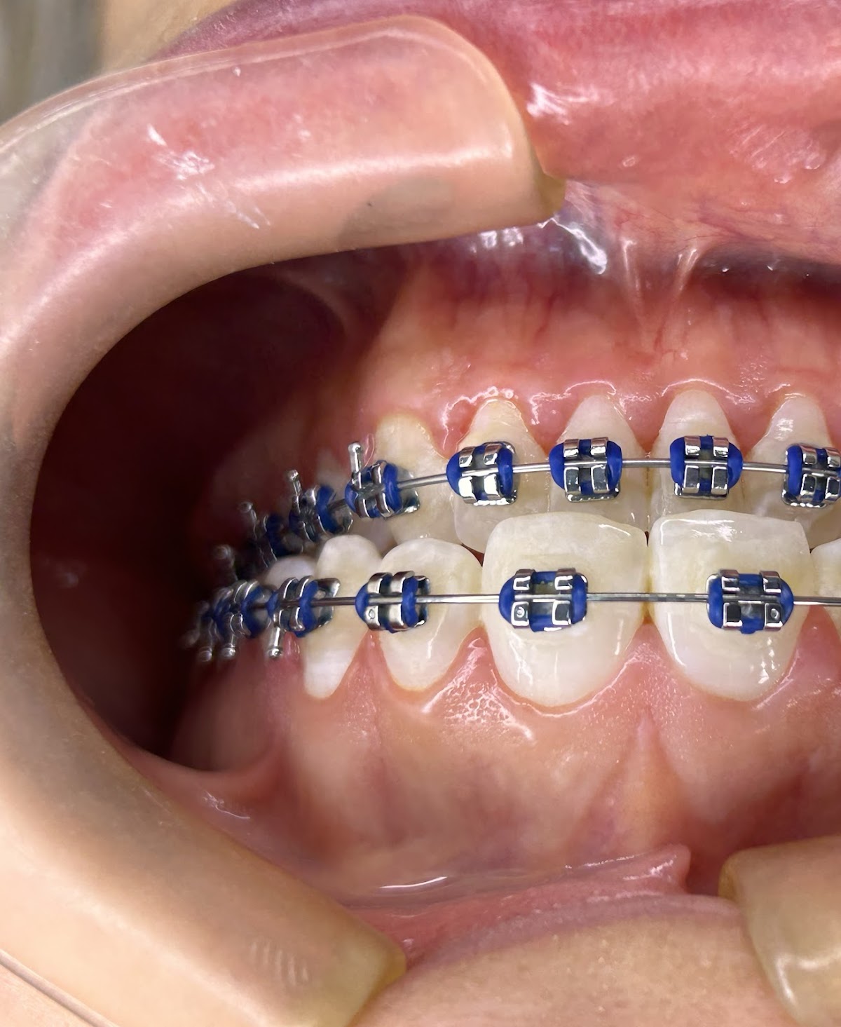 Ortodoncia y Odontologia estética Dra. Vanessa Rivera — foto 4