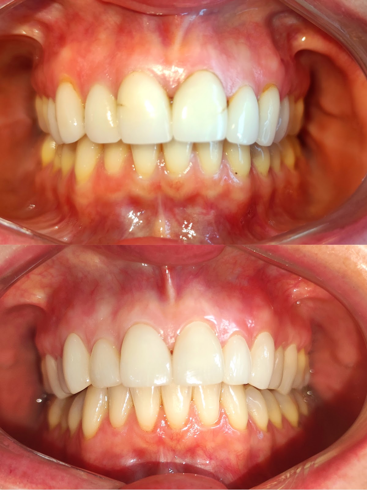 Dentista Cancún HG Odontología Integral