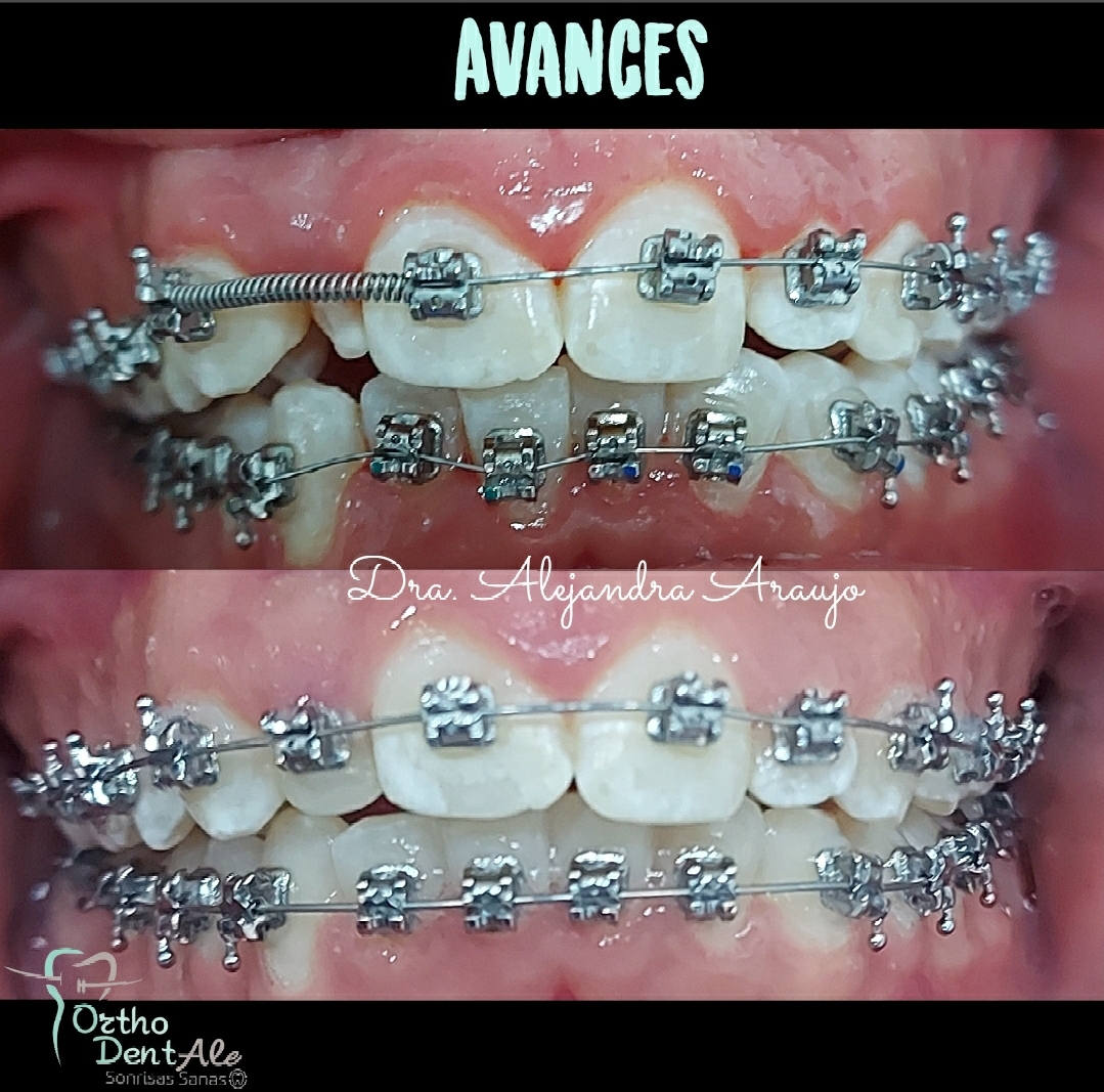 OrthoDentAle Ortodoncista Dra. Ale Araujo — foto 2