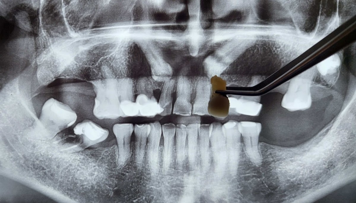 GEO Dental Querétaro - Ortodoncia, Endodoncia, Rehabilitación o Prótesis dental — foto 3