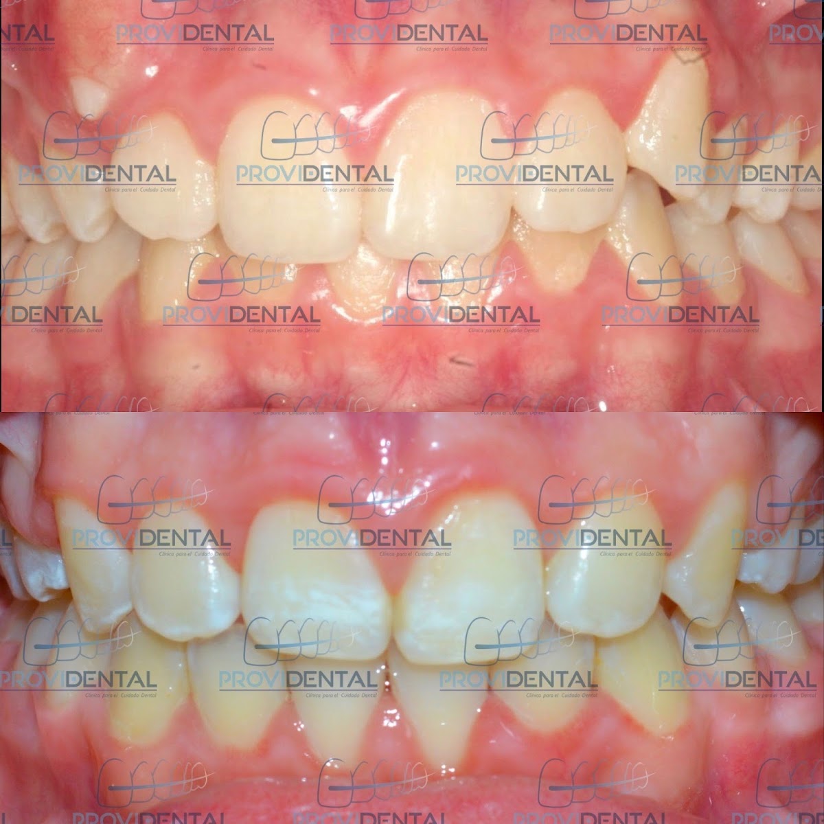 PROVIDENTAL / Ortodoncia e Implantes — foto 2