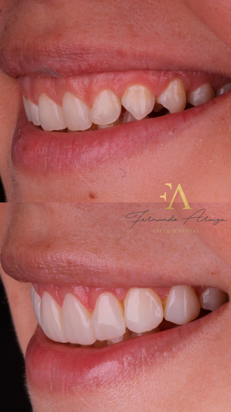 Fernando Araiza Estudio Dental — foto 4