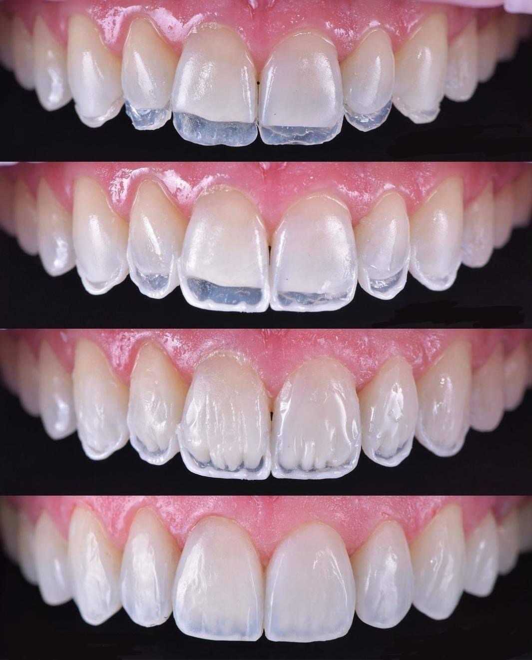 dental ari