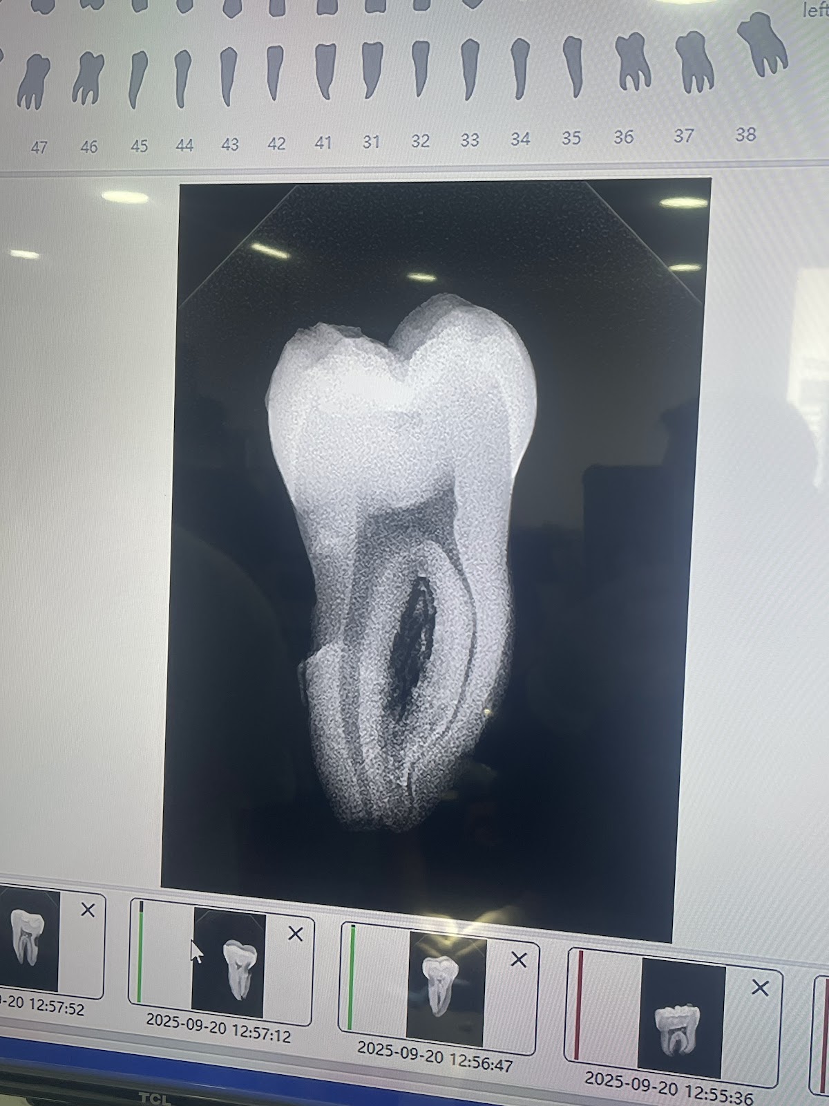 dental ari — foto 4