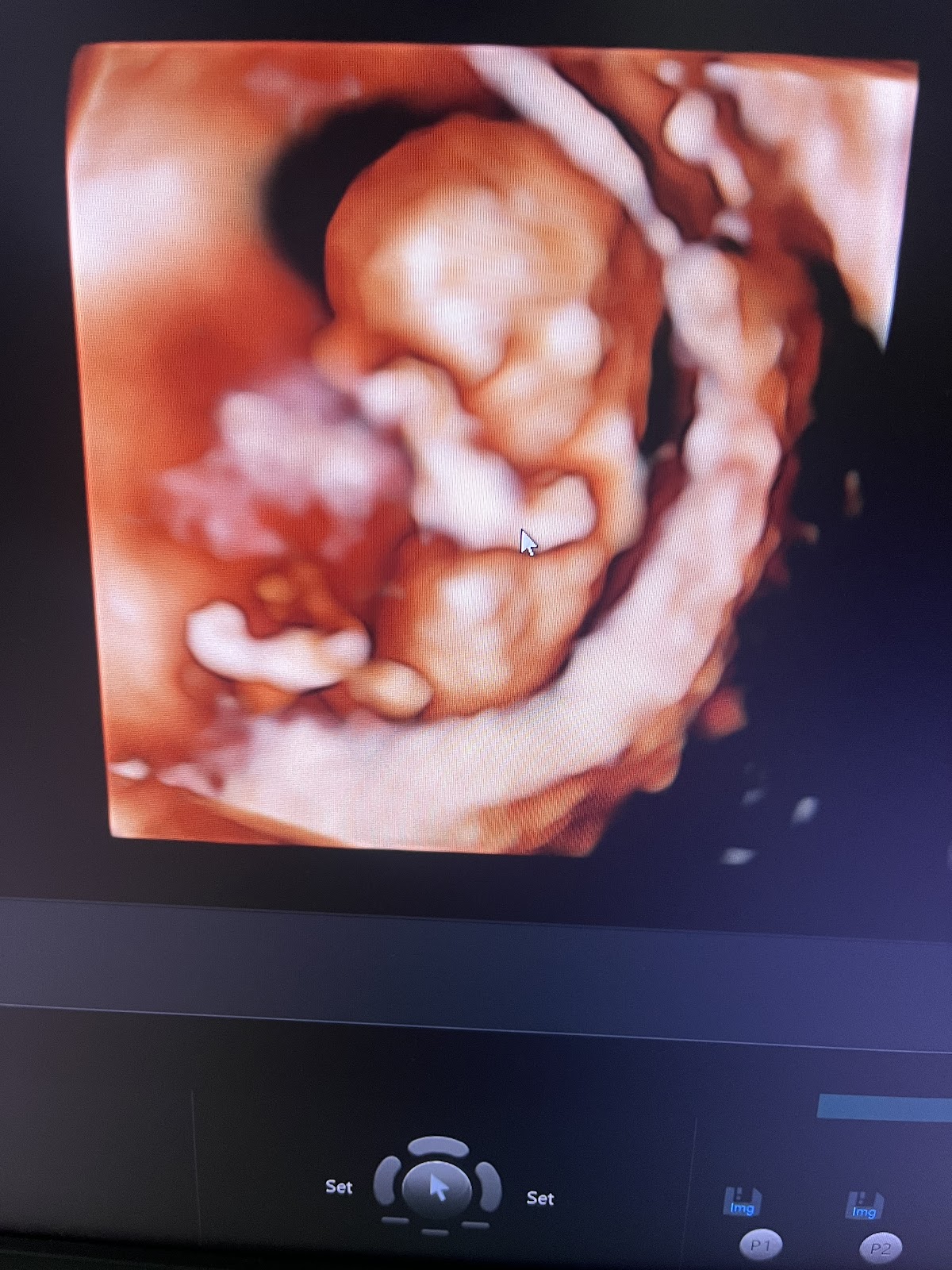 Dra. Ivonne Zapién Ginecóloga — foto 4