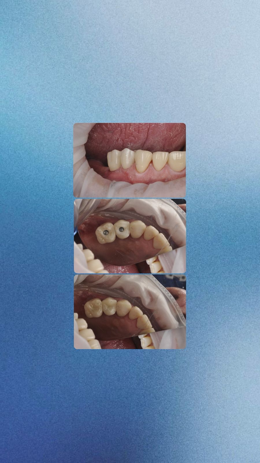 Dr. Leo I Carillas, Diseño de Sonrisa y Rehabilitacion Oral — foto 2