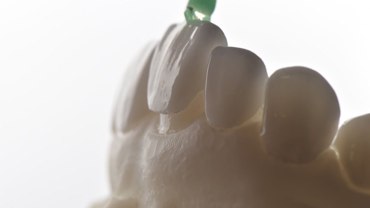 Gallery dental Clinic