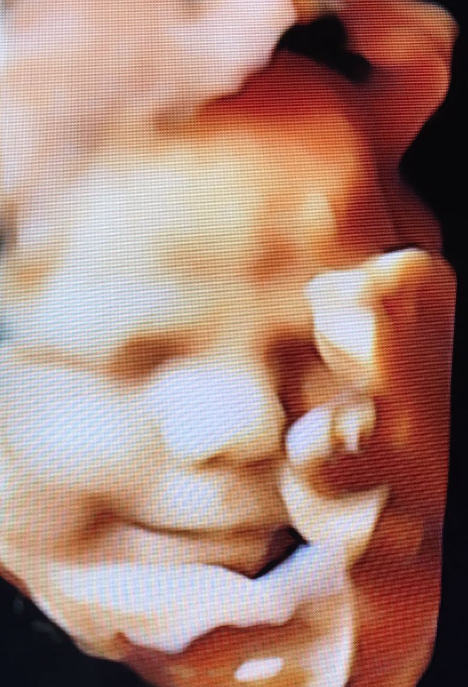 Unidad Médica de Evaluación Fetal — foto 2