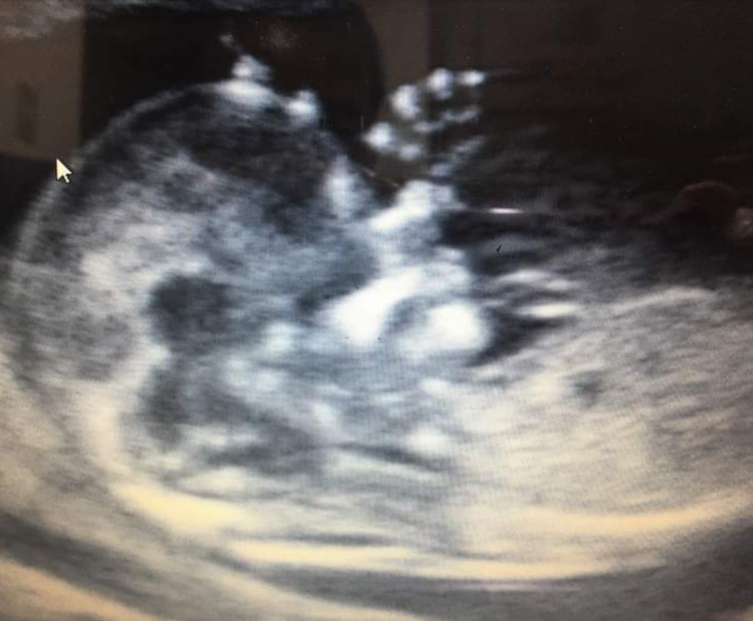 Unidad Médica de Evaluación Fetal — foto 3