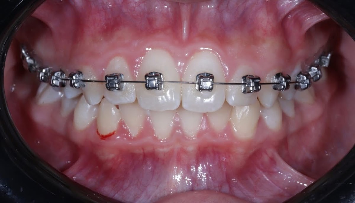 Dra. Joselyne Rodriguez, Dentista - Odontólogo — foto 2