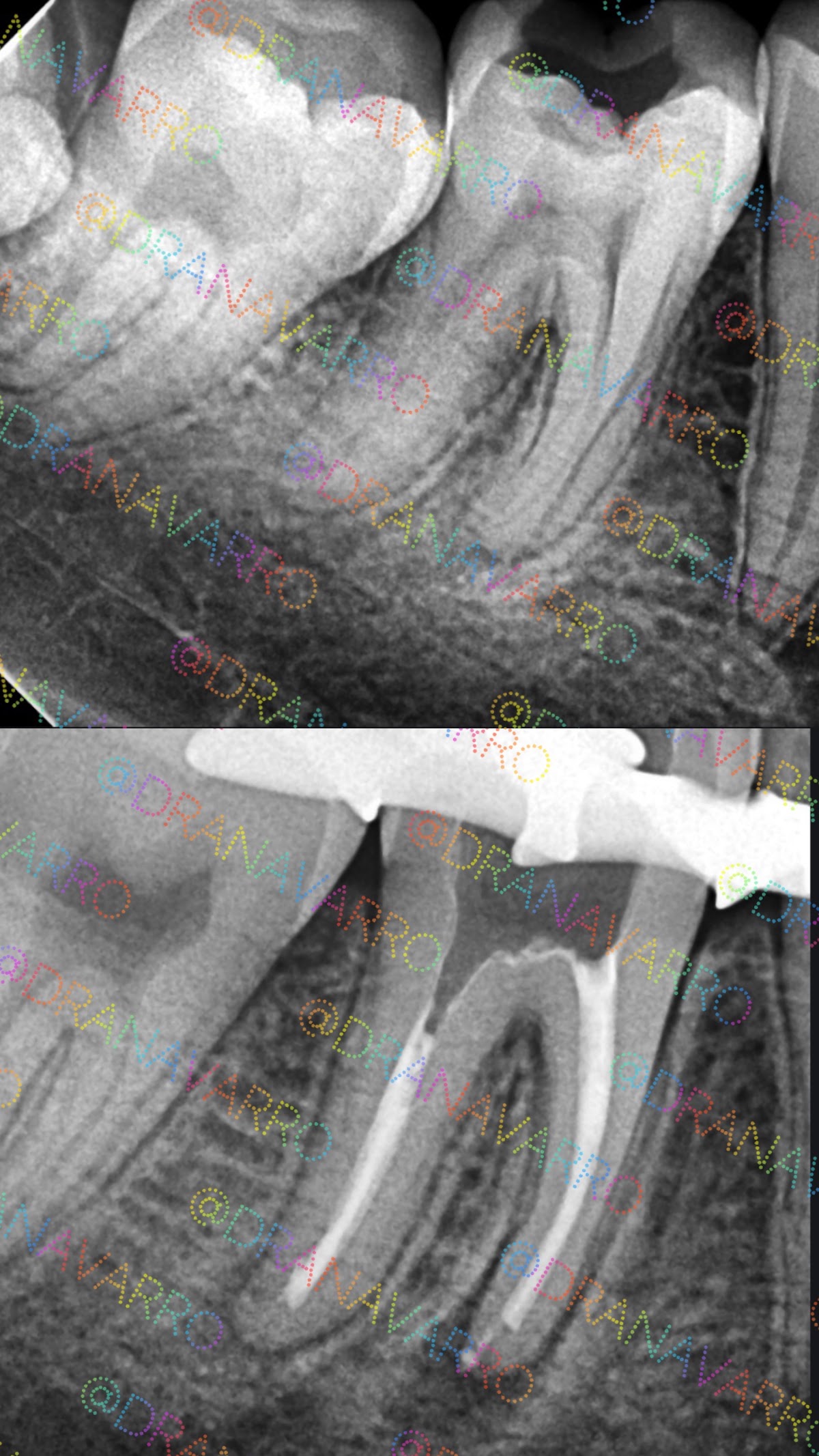 Especialista en Dolor Dental - Endodoncia Dra. Navarro. — foto 4