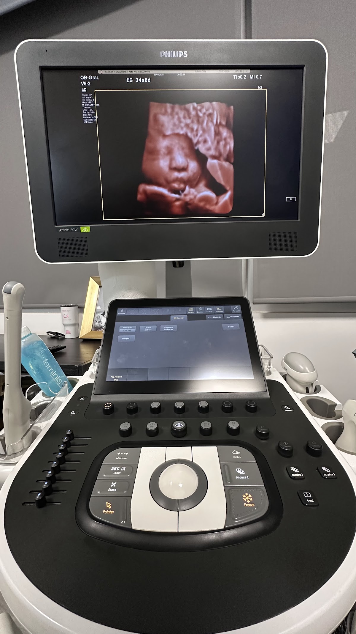 Ginecología y Obstetricia Moderna - Ginecólogos en León — foto 2