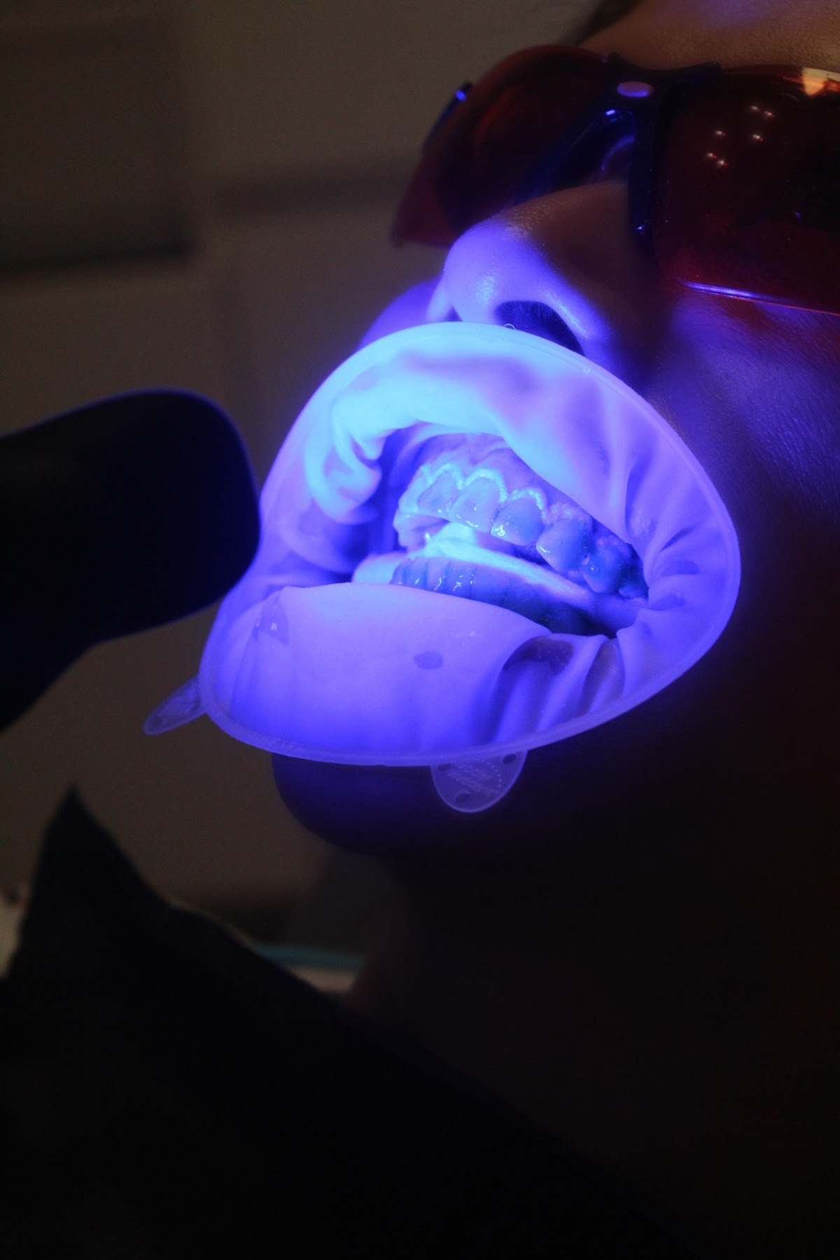 Dentista Providencia Andrea De la Cruz, Odontología estética y Bienestar bucal — foto 4