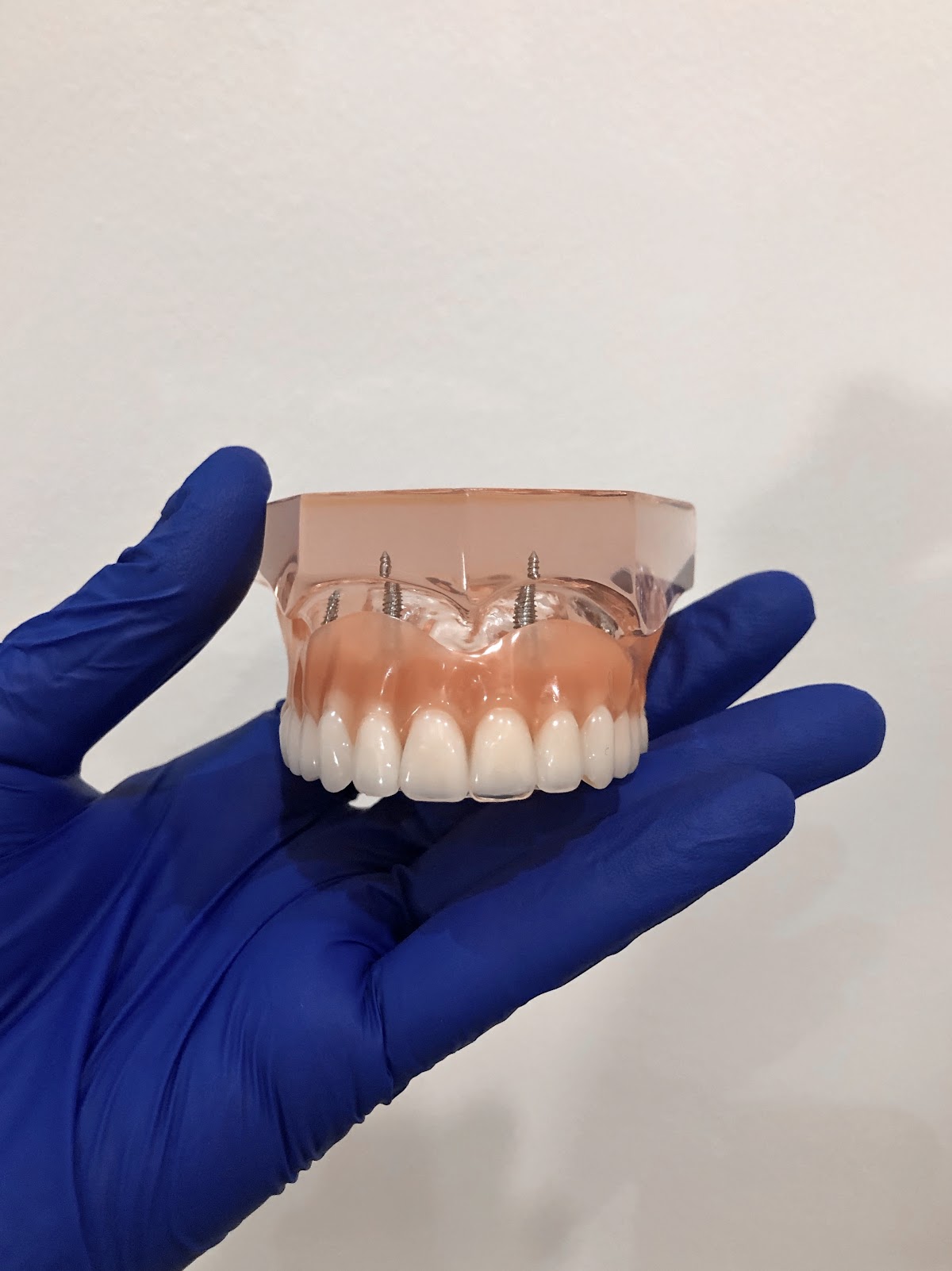 Dr. Dalia Dental Care Tijuana, B.C. — foto 4