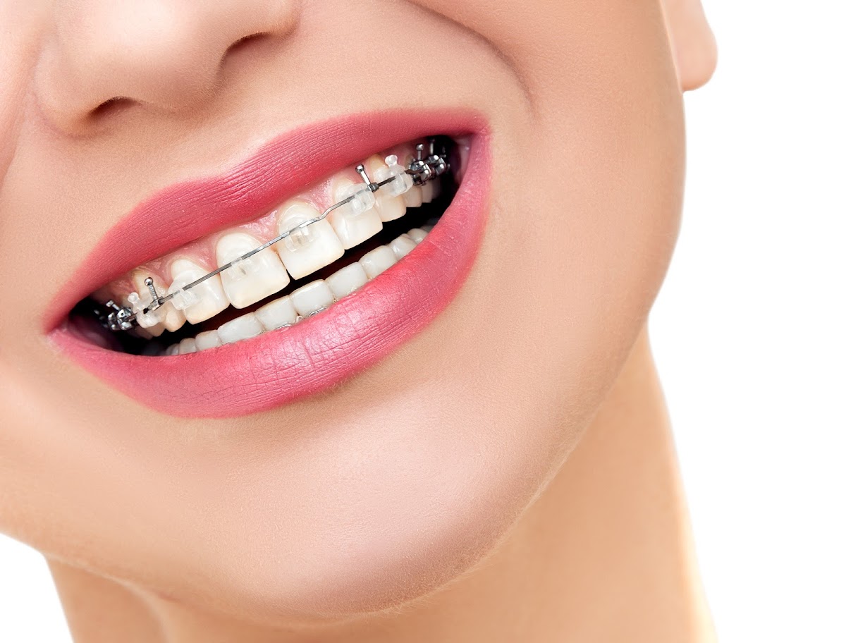 Dental Vasconcelos