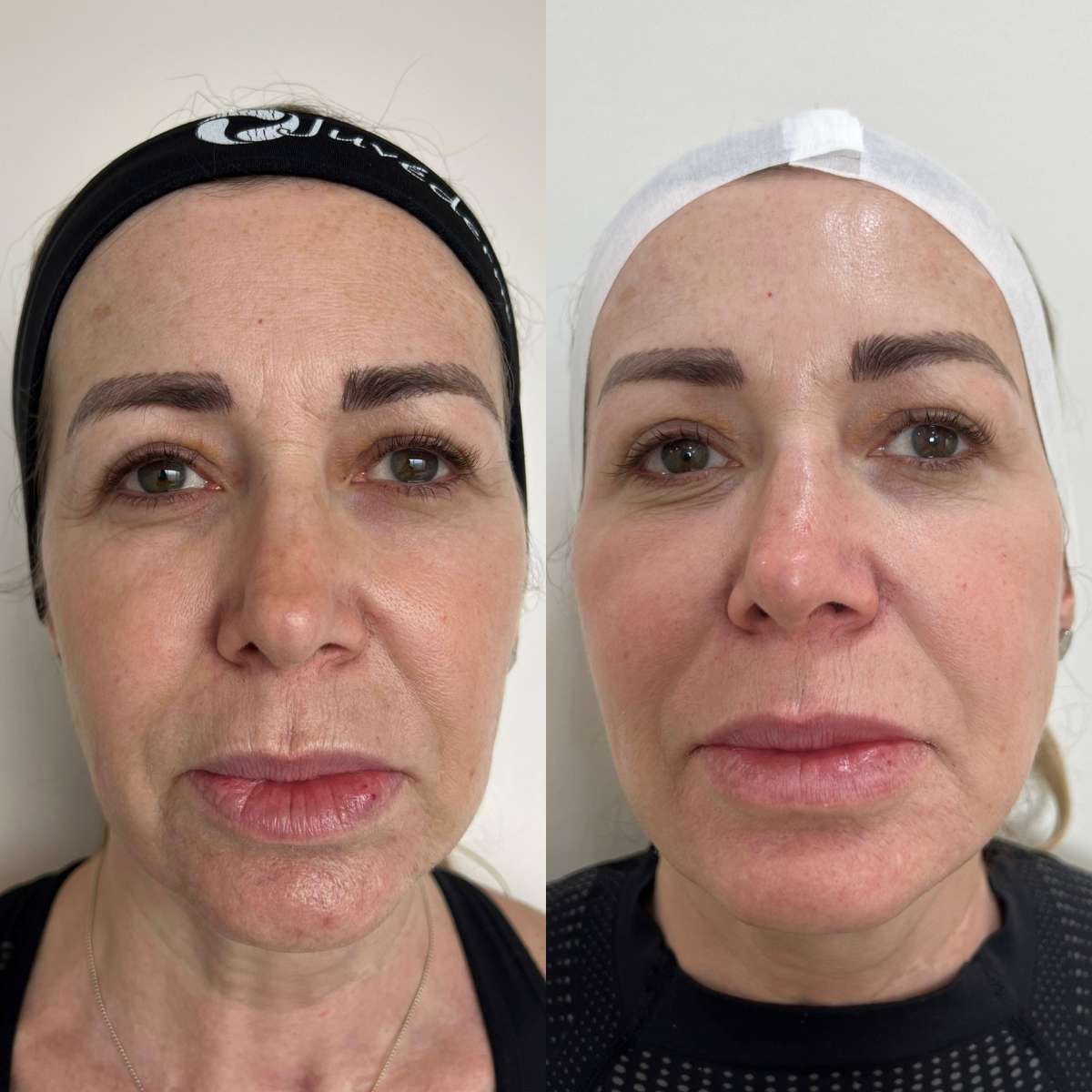 Dermatólogo | Dr. Miguel Morales Monsivais — foto 2