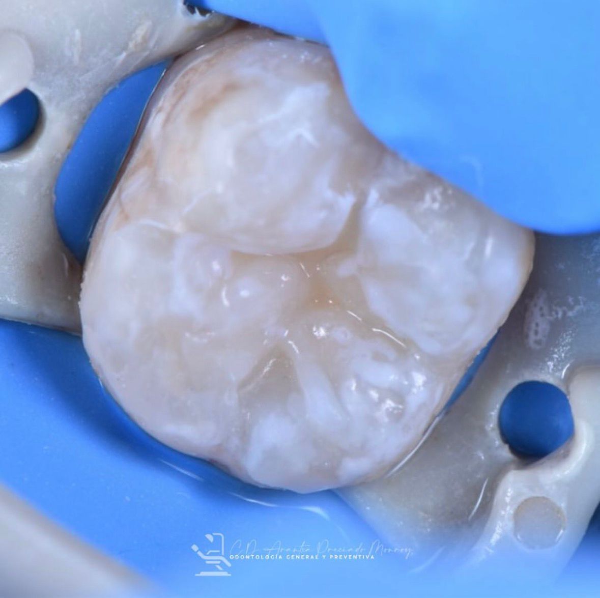 Dra. Arantxa Preciado - Dentista en Guadalajara Odontologia General y Preventiva — foto 2