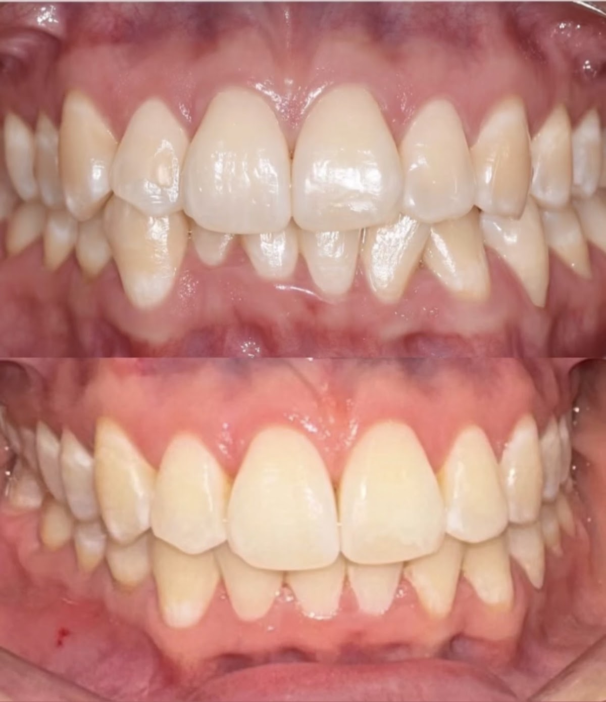 Ortodoncia|odontologia integral|Dra Mayra Acevedo — foto 2