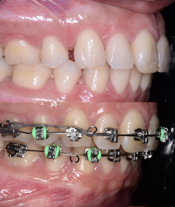 Ortodoncia y Ortopedia Maxilar. Odontología general. Dr André Blanco Villegas — foto 3