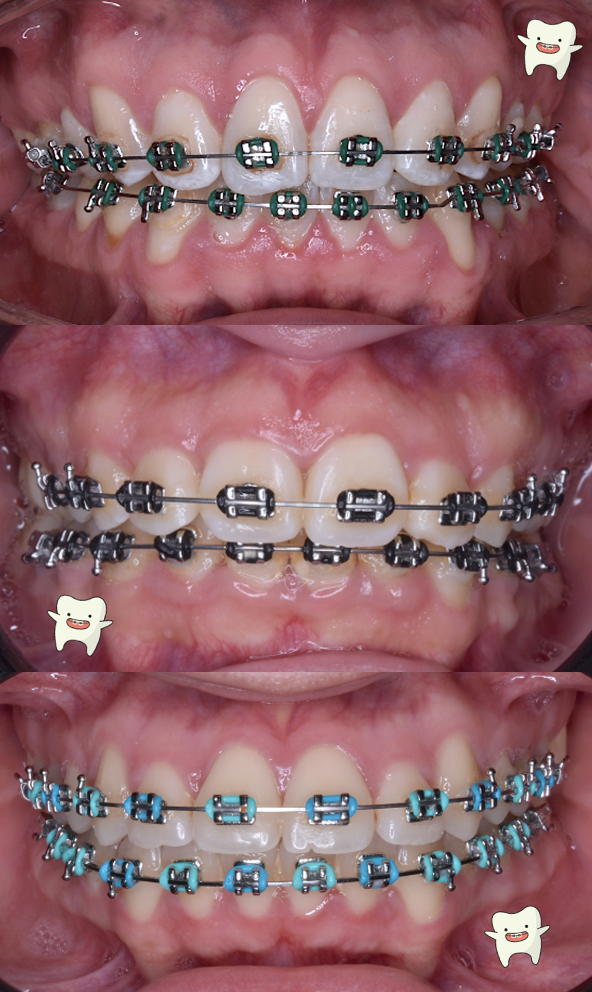 Ortodoncia y Ortopedia Maxilar. Odontología general. Dr André Blanco Villegas — foto 4