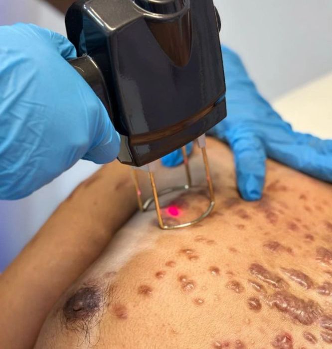 Dr Enrique Ramales y Rossano. Dermatología, Alergia y Cosmiatria Medica