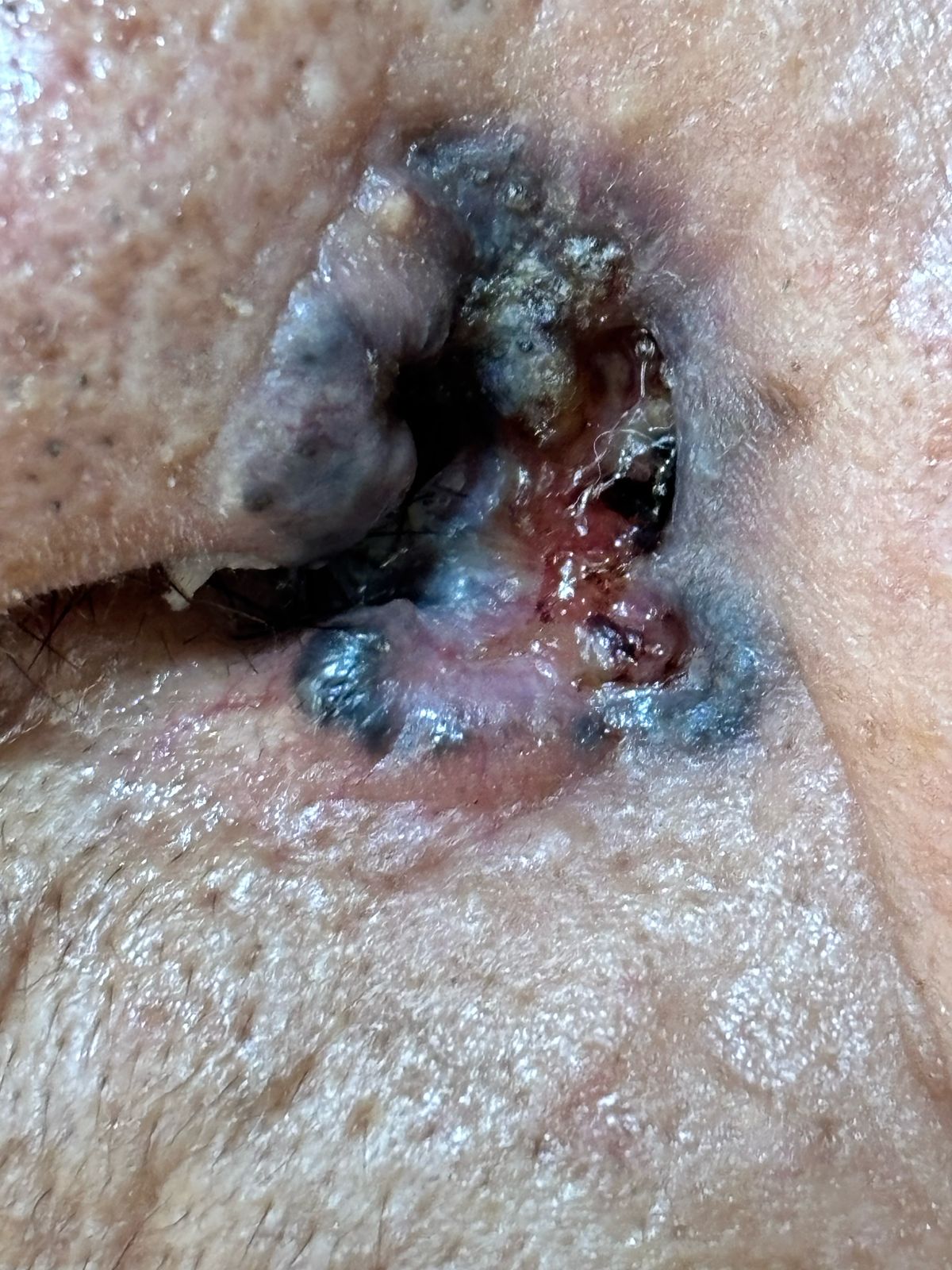 Dr Enrique Ramales y Rossano. Dermatología, Alergia y Cosmiatria Medica — foto 2