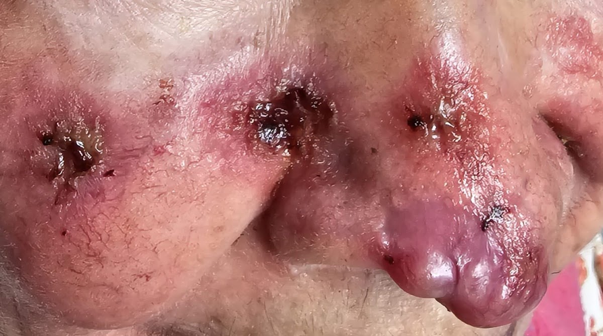 Dr Enrique Ramales y Rossano. Dermatología, Alergia y Cosmiatria Medica — foto 3
