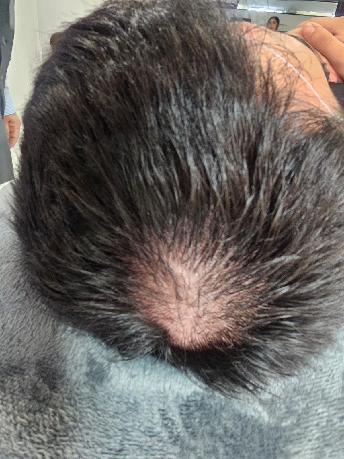 Dr Enrique Ramales y Rossano. Dermatología, Alergia y Cosmiatria Medica — foto 4