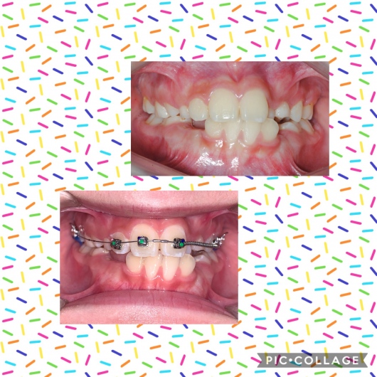 Dra. Rocio Selenia Vázquez Cruz, Dentista - Odontólogo — foto 2