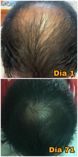 Dra. Mary Diana Gutiérrez Lavadores, Dermatólogo — foto 2