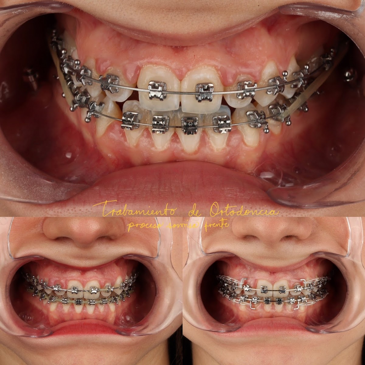 Zahnarzt Estudio Dental- Cumbres - consultorio dental — foto 2