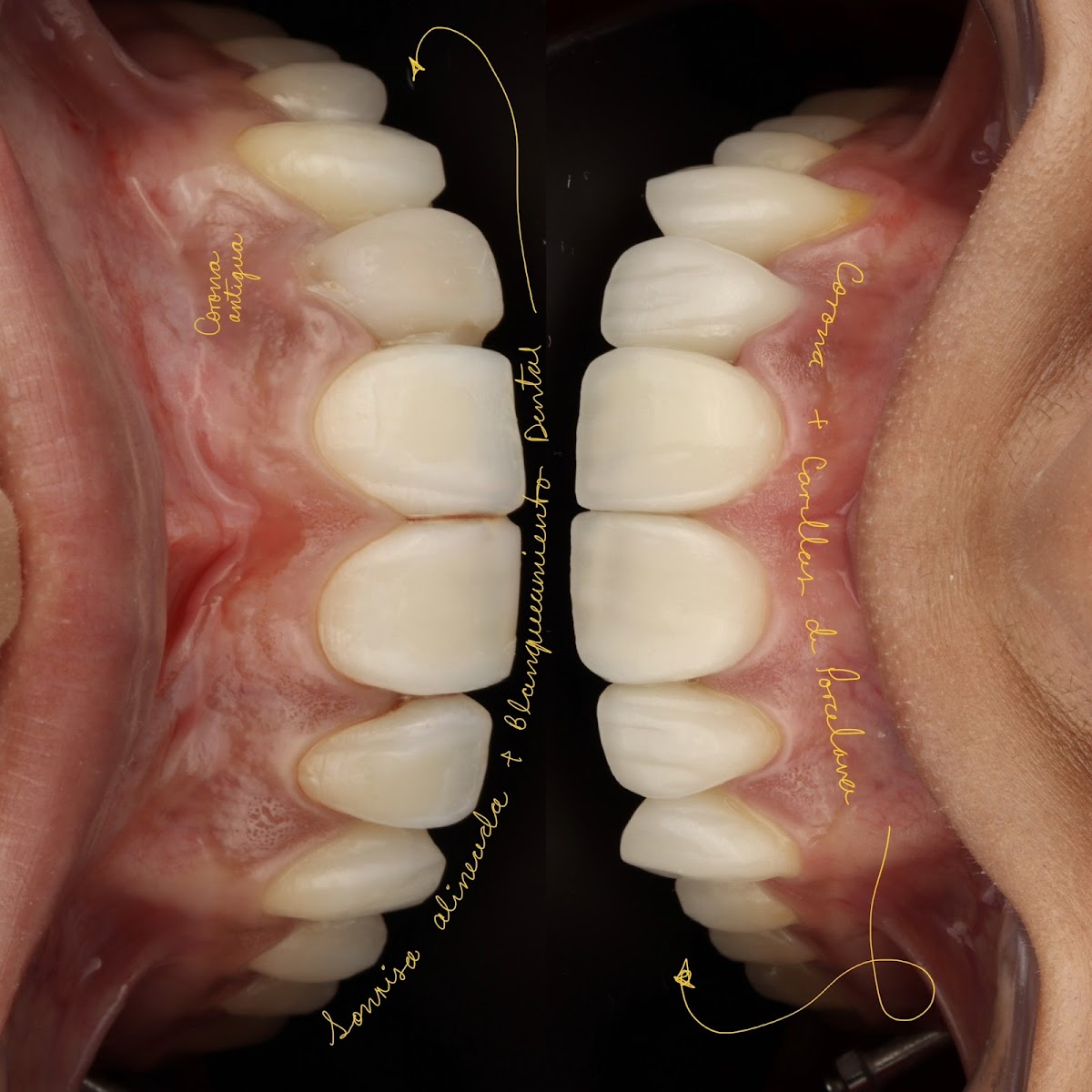 Zahnarzt Estudio Dental- Cumbres - consultorio dental — foto 3