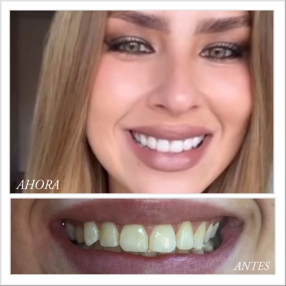 Dra. Mónica Alonso - Odontología Estética Avanzada — foto 4