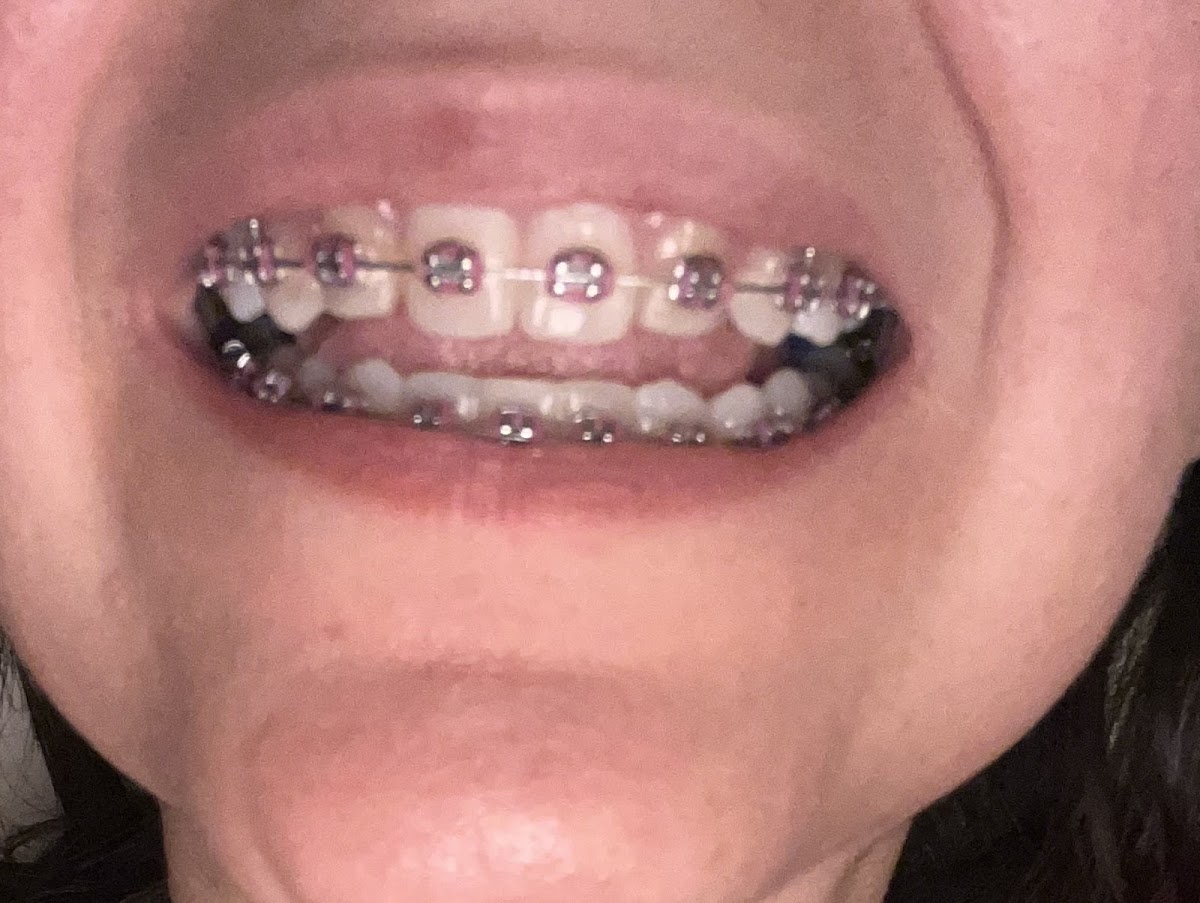 Elite Smile Dental Group — foto 4