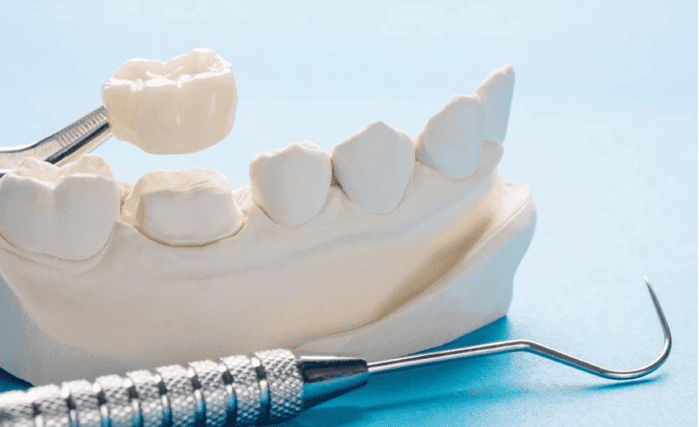 Endodoncia en San Pedro Xalpa - Dr. Daniel Salvatierra — foto 2