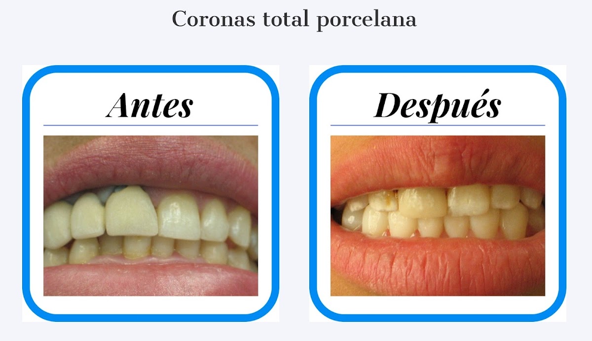Dentistas en Aguascalientes Dental Corporativa — foto 4