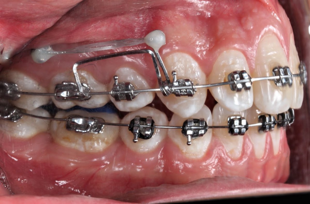CIRUGIA MAXILOFACIAL Y ORTODONCIA — foto 2