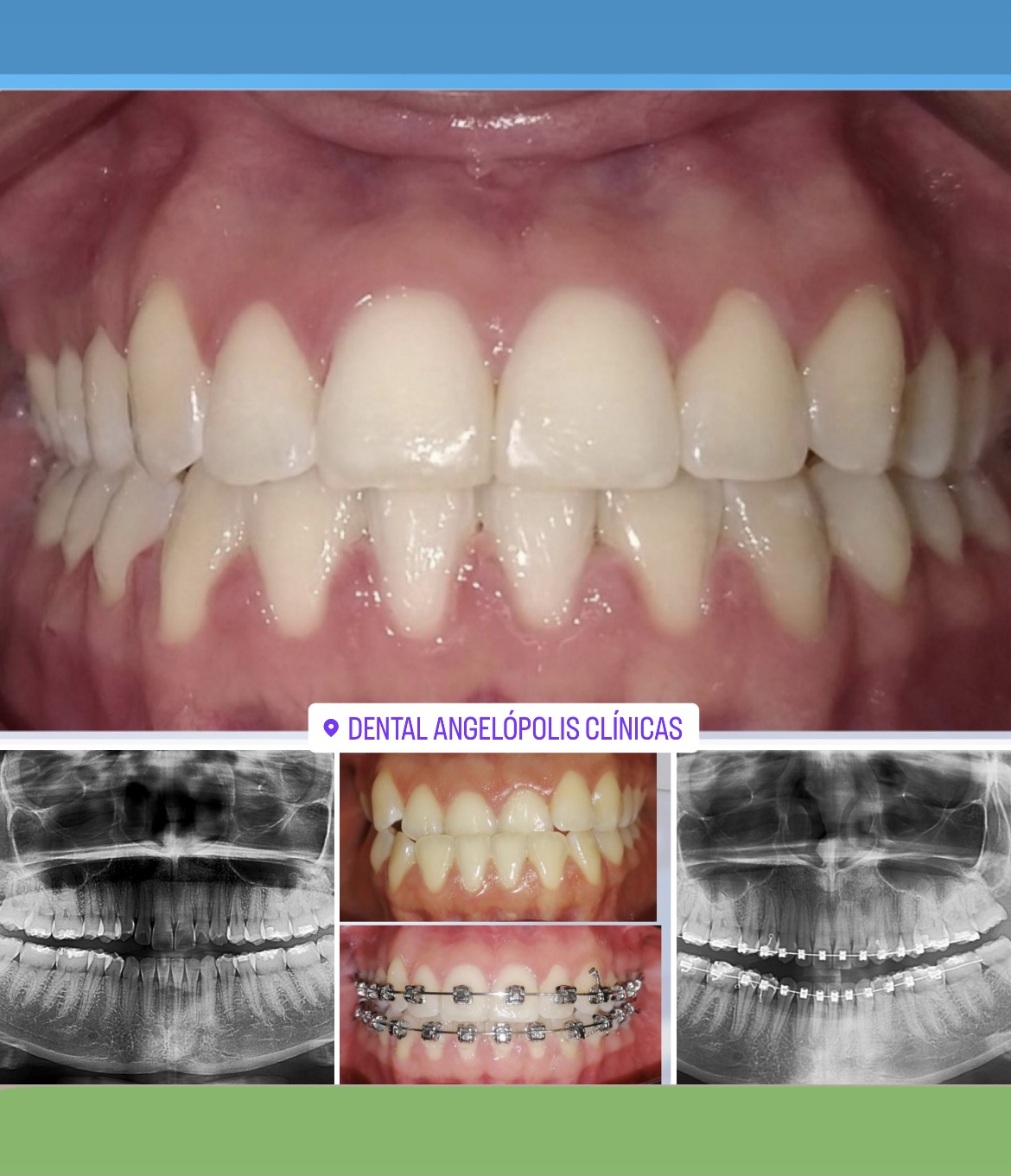 Dental Angelopolis — foto 2