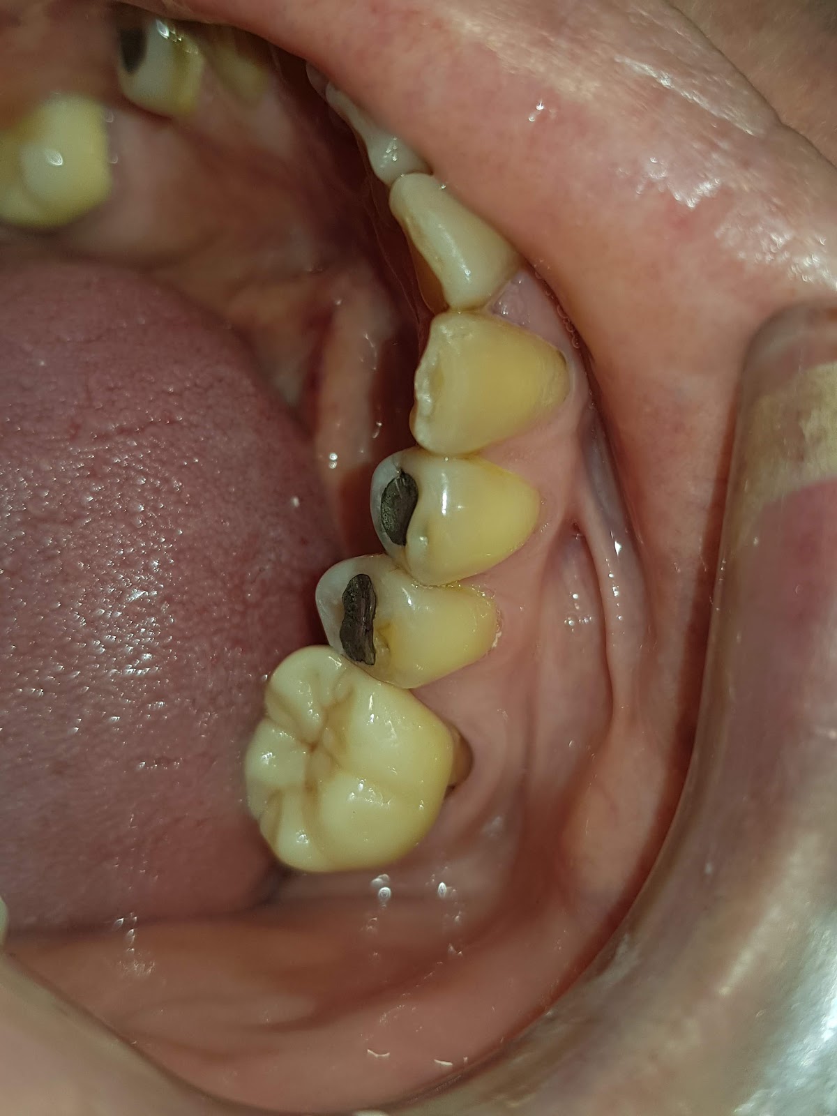 Dra Salgado especialista en n ortodonci. Manejo del dolor. Cirugía bucal… — foto 3
